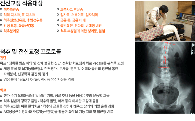 ���ű��� ������. ô�� �� ���ű��� ��������