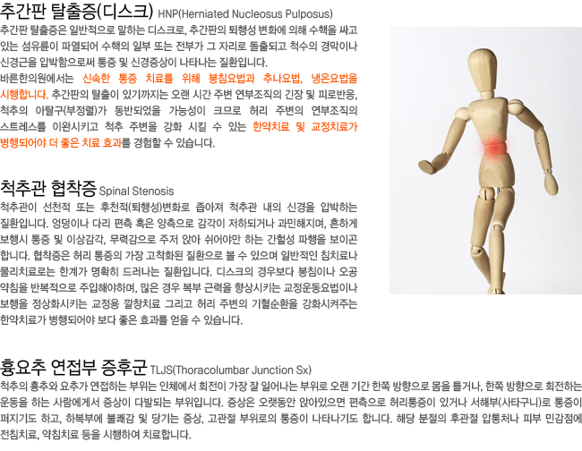 �߰���Ż����(��ũ). ô�߰�������. ����� ������ ���ı�