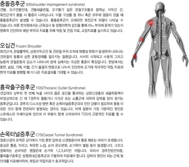 �浹���ı�. ���ʰ�. ����ⱸ���ı�. �ո��ͳ����ı�